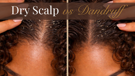 Dry Scalp vs Dandruff: How to Tell the Difference (Especially If You Have Curly Hair)
